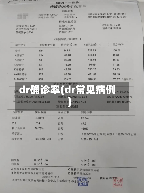 dr确诊率(dr常见病例)-第2张图片
